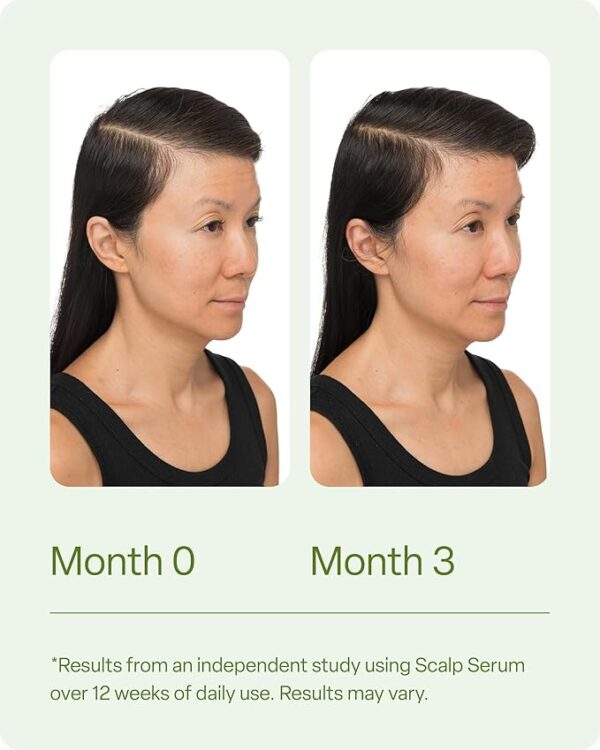 Divi Scalp Serum for Thinning Hair, 30ml – Clinically Tested, Nourishing Formula with Amino Acids, Caffeine & Rosemary Oil – Promotes Healthy Scalp & Fuller-Looking Hair, Reduces Oil & Product Buildup - Image 2