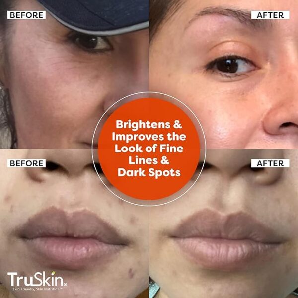 TruSkin Vitamin C Serum For Face – Anti Aging Formula with Vitamin C, Hyaluronic Acid, Vitamin E – Brightening Serum – Improve Appearance of Dark Spots, Tone, Fine Lines & Wrinkles, 2 Fl Oz - Image 2